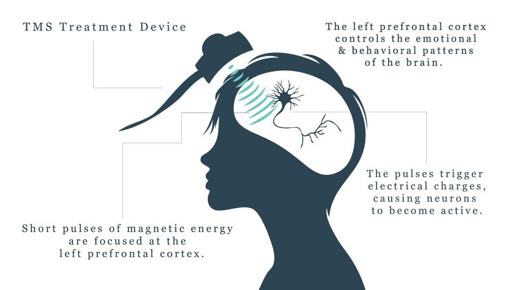 Mindful Health Solutions’ Doctors Strive to Combat Depression with Exceptional Care